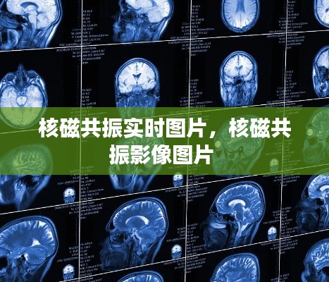 核磁共振实时图片，核磁共振影像图片 